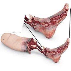 Injury Simulator - Leg Bleeding